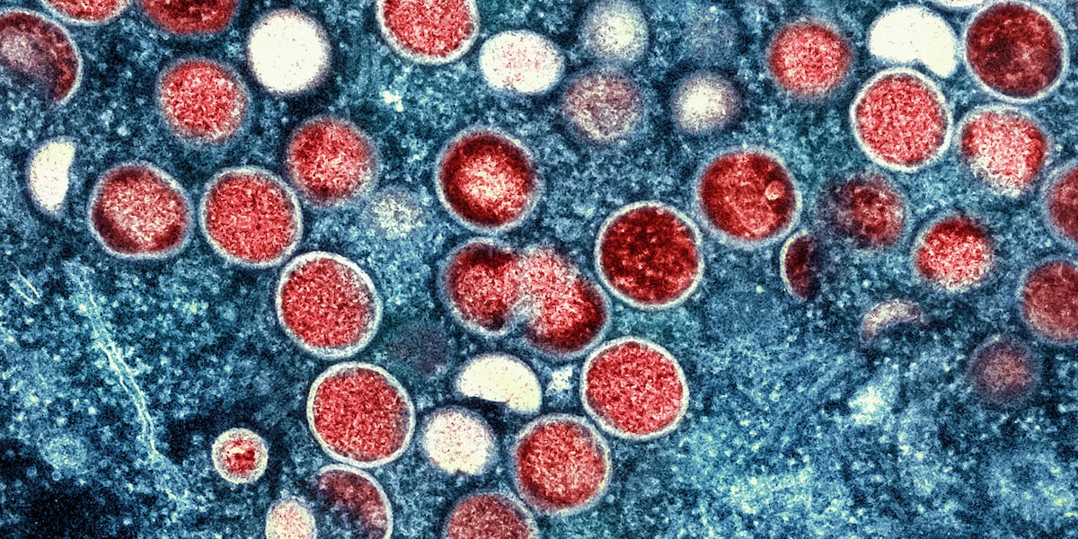 Wisconsin health officials report first mpox cases of 2026